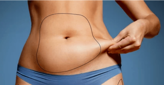 Complexes for rapid weight loss